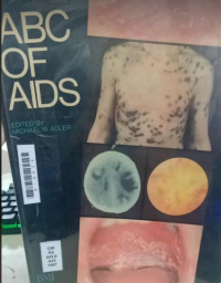 Image of ABC of AIDS