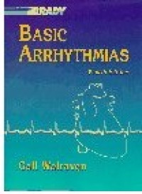 Basic Arrhythmias