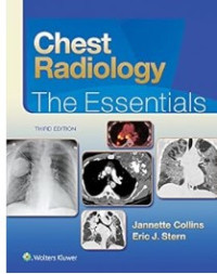 Image of Chest radiology the essentials